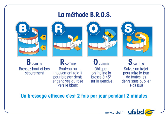 La méthode B.R.O.S. de l’UFSBD pour un brossage des dents efficace