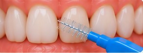 Brossette interdentaire passée dans un espace des dents du haut
